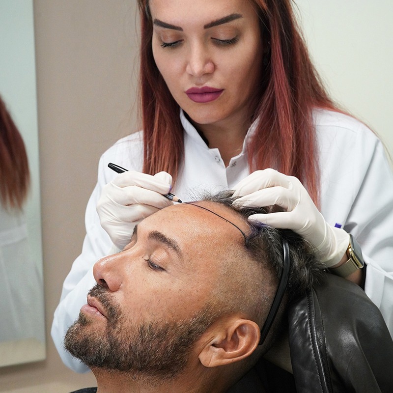 Hair Transplant Istanbul with Advanced Follicular Extraction Methods